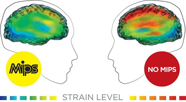 MIPS brain impact